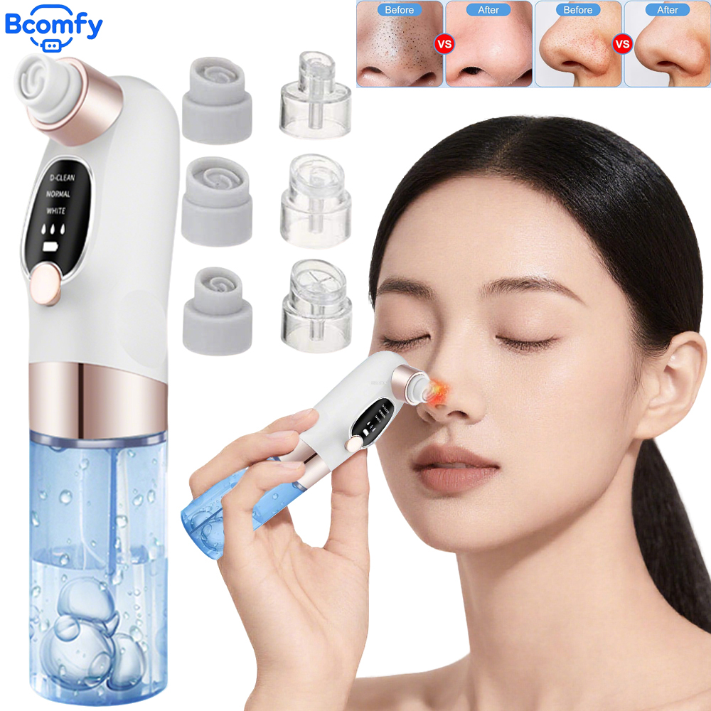 Electric Blackhead Remover Ski - Embroidery Removal avaliação e preço