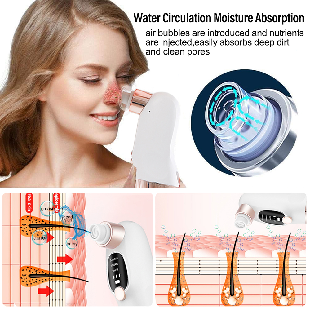 Electric Blackhead Remover Ski - Embroidery Removal avaliação e preço